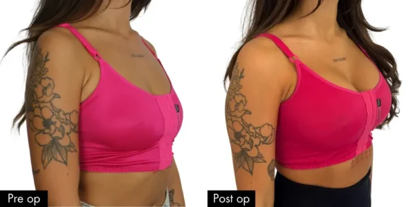 The MYA Pink bra - Image 3